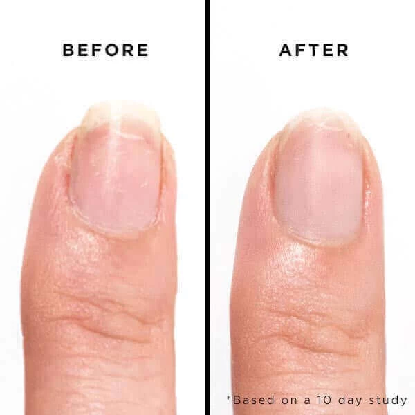 Bramley Apple Jelly Preserve Strengthening Treatment 4 Bramley Apple Jelly Preserve Strengthening Treatment - Image 4