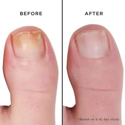 Mellow The Yellow Nail Brightening Treatment -Butter London Shop mellow the yellow nail brightening treatmentnail treatments 788110