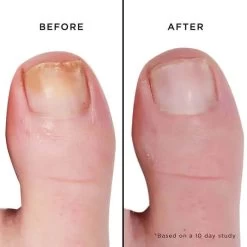 Fashion Size Mellow The Yellow Nail Brightening Treatment -Butter London Shop mini mellow the yellow nail brightening treatment 488829