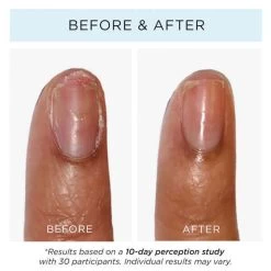 Fashion Size Strawberry Rhubarb Jelly Preserve Strengthening Treatment 12 Fashion Size Strawberry Rhubarb Jelly Preserve Strengthening Treatment -Butter London Shop mini strawberry rhubarb jelly preserve strengthening treatment 972513