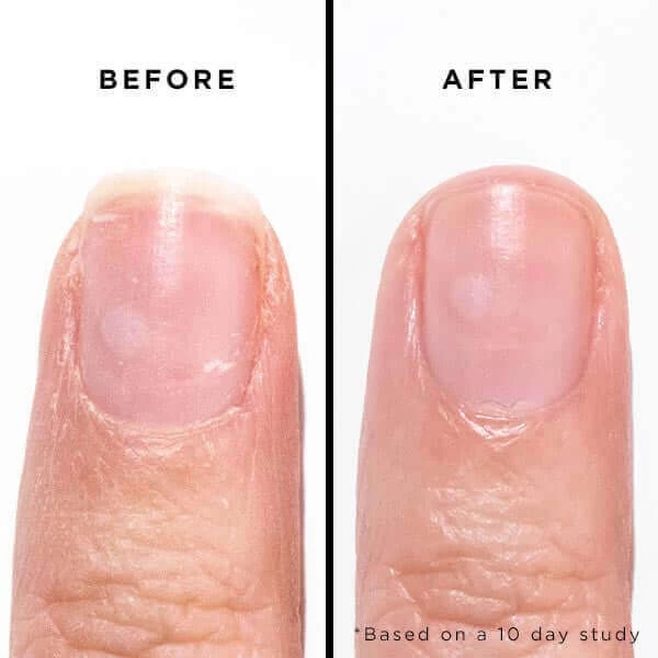 Orange Marmalade Jelly Preserve Strengthening Treatment 5 Orange Marmalade Jelly Preserve Strengthening Treatment - Image 5